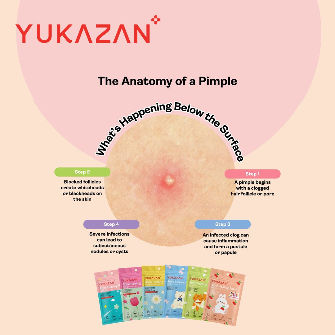 Yukazan Hydrocolloid Acne Healing Patch 20's